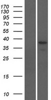 ODF3B Human Over-expression Lysate