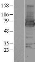 HIP55 (DBNL) Human Over-expression Lysate