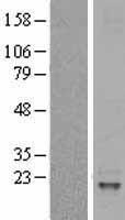 IL31 Human Over-expression Lysate