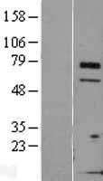TCTN3 Human Over-expression Lysate