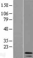IRF1-AS1 Human Over-expression Lysate