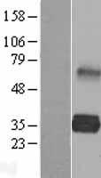 LDLRAD2 Human Over-expression Lysate