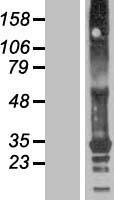 TMEM82 Human Over-expression Lysate