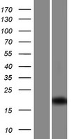C1orf192 (CFAP126) Human Over-expression Lysate