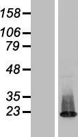 ZNF385C Human Over-expression Lysate