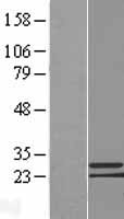 C9orf152 Human Over-expression Lysate