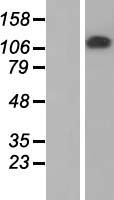 ZKSCAN2 Human Over-expression Lysate