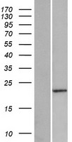 PABPC1L2A Human Over-expression Lysate