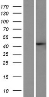 SLX4IP Human Over-expression Lysate