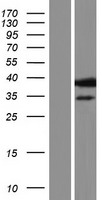 TCP1 eta (CCT7) Human Over-expression Lysate