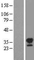 STK16 Human Over-expression Lysate
