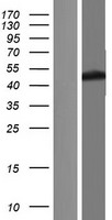 FECH Human Over-expression Lysate