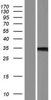 Shugoshin (SGO1) Human Over-expression Lysate
