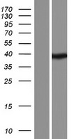 Shugoshin (SGO1) Human Over-expression Lysate