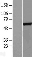 CTU2 Human Over-expression Lysate