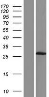DUXA Human Over-expression Lysate
