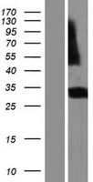 RGR Human Over-expression Lysate