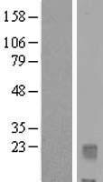 IL32 Human Over-expression Lysate