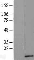 C18orf56 (TYMSOS) Human Over-expression Lysate