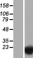 SPRR2B Human Over-expression Lysate