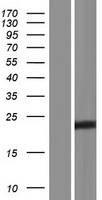 CT45A6 Human Over-expression Lysate