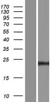 CT45A4 Human Over-expression Lysate