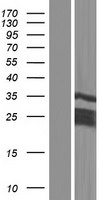 CT45A3 Human Over-expression Lysate