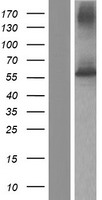 Folylpolyglutamate synthase (FPGS) Human Over-expression Lysate