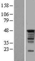 SERBP1 Human Over-expression Lysate