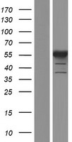PFKFB2 Human Over-expression Lysate