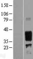 EMA (MUC1) Human Over-expression Lysate