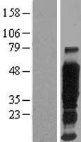 EMA (MUC1) Human Over-expression Lysate