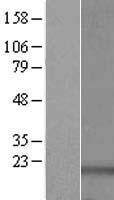 RPS16 Human Over-expression Lysate