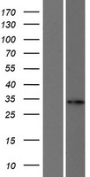 FANCA Human Over-expression Lysate