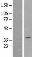 C 4 Methylsterol Oxidase (MSMO1) Human Over-expression Lysate