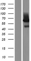 Liver Carboxylesterase 1 (CES1) Human Over-expression Lysate
