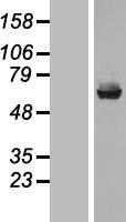 Liver Carboxylesterase 1 (CES1) Human Over-expression Lysate