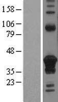 DHLAG (CD74) Human Over-expression Lysate