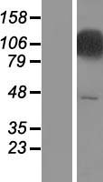 ADAR1 (ADAR) Human Over-expression Lysate