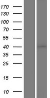 Casein Kinase 1 alpha (CSNK1A1) Human Over-expression Lysate