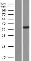 BRMS1 Human Over-expression Lysate