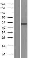 Argininosuccinate Lyase (ASL) Human Over-expression Lysate