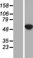Argininosuccinate Lyase (ASL) Human Over-expression Lysate