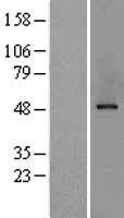 AP2M1 Human Over-expression Lysate