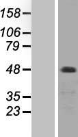PKC zeta (PRKCZ) Human Over-expression Lysate