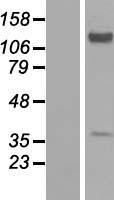 EXTL2 Human Over-expression Lysate