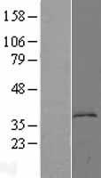 L Kynurenine Hydrolase (KYNU) Human Over-expression Lysate
