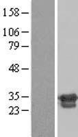 ZNF174 Human Over-expression Lysate