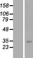 TFPI Human Over-expression Lysate