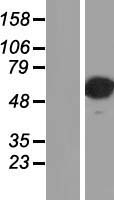 AP2 alpha (TFAP2A) Human Over-expression Lysate
